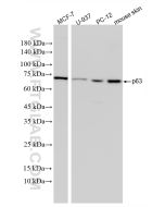 DeltaN p63 Recombinant monoclonal antibody proteintech 86154-11-RR