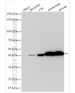 CKB-Specific Recombinant monoclonal antibody proteintech 83522-5-RR