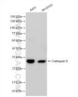 Cathepsin D Recombinant monoclonal antibody proteintech 83743-2-RR