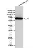 AFP Recombinant monoclonal antibody proteintech 82982-6-RR