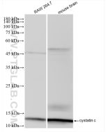 Cystatin C Recombinant monoclonal antibody proteintech 83422-1-RR