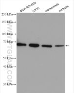 PLK1 Polyclonal antibody Proteintech  10305-1-AP