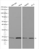 CDKN2A/P16-INK4A Polyclonal antibody Proteintech  10883-1-AP