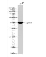 Cyclin E1 Recombinant monoclonal antibody Proteintech  82700-10-RR