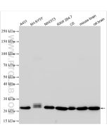 RAB7A Recombinant monoclonal antibody Proteintech  84741-1-RR