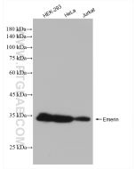 Emerin Recombinant monoclonal antibody Proteintech  82888-3-RR
