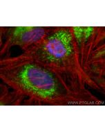 Anti-Human CD107b / LAMP2 (H4B4) Mouse IgG2a Recombinant Antibody Proteintech  65566-1-MR