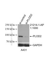 PLOD2 Polyclonal antibody Proteintech  21214-1-AP