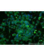 Anti-Mouse CD11b (M1/70) Rat IgG2a Recombinant Antibody Proteintech  65672-1-TR