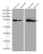 TOM70 Polyclonal antibody Proteintech  14528-1-AP