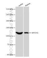 MYO1G Recombinant monoclonal antibody Proteintech  83556-5-RR