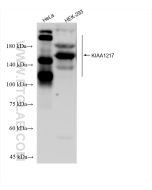 KIAA1217 Recombinant monoclonal antibody Proteintech  83361-2-RR