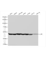 LBR Recombinant monoclonal antibody Proteintech  84522-6-RR