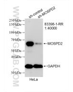MOSPD2 Recombinant monoclonal antibody Proteintech  83398-1-RR