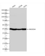 MAGEA4 Recombinant monoclonal antibody Proteintech  84248-6-RR