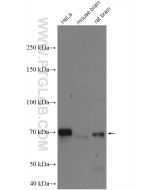 OPTN/Optineurin Polyclonal antibody Proteintech  10837-1-AP