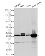 NDRG1 Polyclonal antibody Proteintech  26902-1-AP