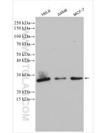 P27; KIP1 Polyclonal antibody Proteintech  25614-1-AP