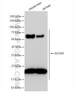 ACOX1 Recombinant monoclonal antibody Proteintech  83731-2-RR
