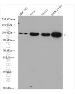 golgin 97 Polyclonal antibody Proteintech  12640-1-AP