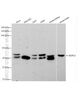 NDRG1 Recombinant monoclonal antibody Proteintech  85141-4-RR