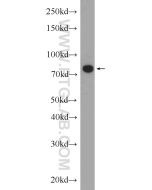 MCM7 Polyclonal antibody Proteintech  11225-1-AP