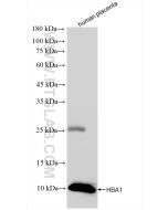 Hemoglobin Alpha Recombinant monoclonal antibody Proteintech  83185-5-RR