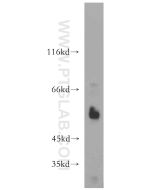 WT1 Polyclonal antibody Proteintech  12609-1-AP