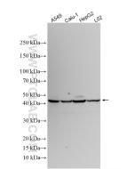 Amphiregulin Polyclonal antibody Proteintech  16036-1-AP