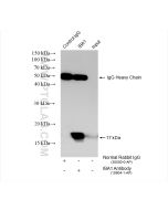 IBA1 Polyclonal antibody Proteintech  10904-1-AP