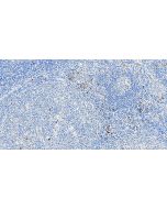 Anti-Human CD15 Rabbit Recombinant Antibody Proteintech  98616-1-RR