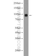 GLAST/EAAT1 Polyclonal antibody Proteintech  20785-1-AP