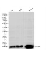 S100B Recombinant monoclonal antibody Proteintech  82271-8-RR