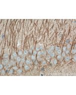 MAP2 Monoclonal antibody Proteintech  67015-1-Ig