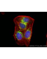 Anti-Human CD107a / LAMP1 Rabbit Recombinant Antibody Proteintech  98266-2-RR