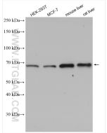 XBP1S-specific Polyclonal antibody Proteintech  24868-1-AP