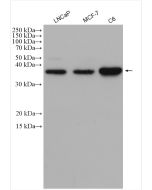 Cyclin D1 Polyclonal antibody Proteintech  26939-1-AP