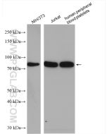 PKC Alpha Polyclonal antibody Proteintech  21991-1-AP