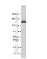 iNOS Polyclonal antibody Proteintech  22226-1-AP