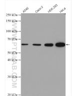 FTO Polyclonal antibody Proteintech  27226-1-AP