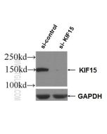 KIF15 Polyclonal antibody Proteintech  55407-1-AP