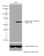Phospho-AKT1 (Ser473) Recombinant monoclonal antibody Proteintech  80462-1-RR