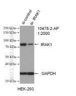IRAK1 Polyclonal antibody Proteintech  10478-2-AP