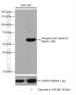 Phospho-AKT (Ser473) Recombinant monoclonal antibody Proteintech  80455-1-RR