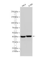 TDP-43 Polyclonal antibody Proteintech  10782-2-AP