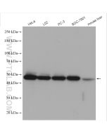 ENO1 Polyclonal antibody Proteintech  11204-1-AP