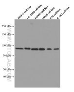 FGFR1 Monoclonal antibody Proteintech  60325-1-Ig