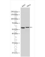 Cytokeratin 7-specific Polyclonal antibody Proteintech  17513-1-AP
