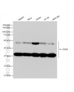 CDK9 Recombinant monoclonal antibody Proteintech  83662-2-RR