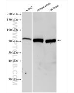 pan-PKC Polyclonal antibody Proteintech  12919-1-AP
